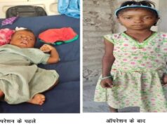 रायपुर: चिरायु योजना बनी बच्चों के लिए वरदान, मुस्कान लौटी, माता-पिता में नई उम्मीद जागी