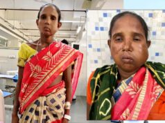 रायपुर में संजीवनी हेल्थ कैंप, प्रशासन की तत्परता से बुधरी मड़कम को एम्स रायपुर में मिला निःशुल्क इलाज