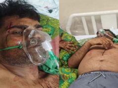 कुल्हाड़ी से हमला: गाली-गलौज का विरोध करने पर पूर्व जनपद सदस्य प्रतिनिधि पर जानलेवा वार