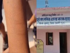 छत्तीसगढ़ के स्कूल में हड़कंप, छात्र ने 12 सहपाठियों को काटा; स्वास्थ्य विभाग मौके पर पहुंचा